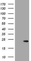 VILIP / VSNL1 Antibody (aa2-191, clone OTI2D8)