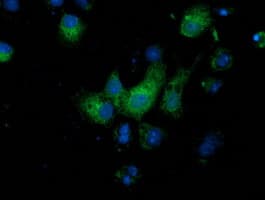 MGRN1 Antibody (clone OTI3A6)