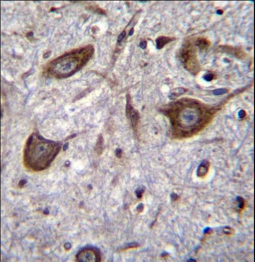 GRIA4 / GLUR4 Antibody (aa296-325)