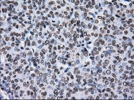 KIAA0153 / TTLL12 Antibody (clone OTI4B2)