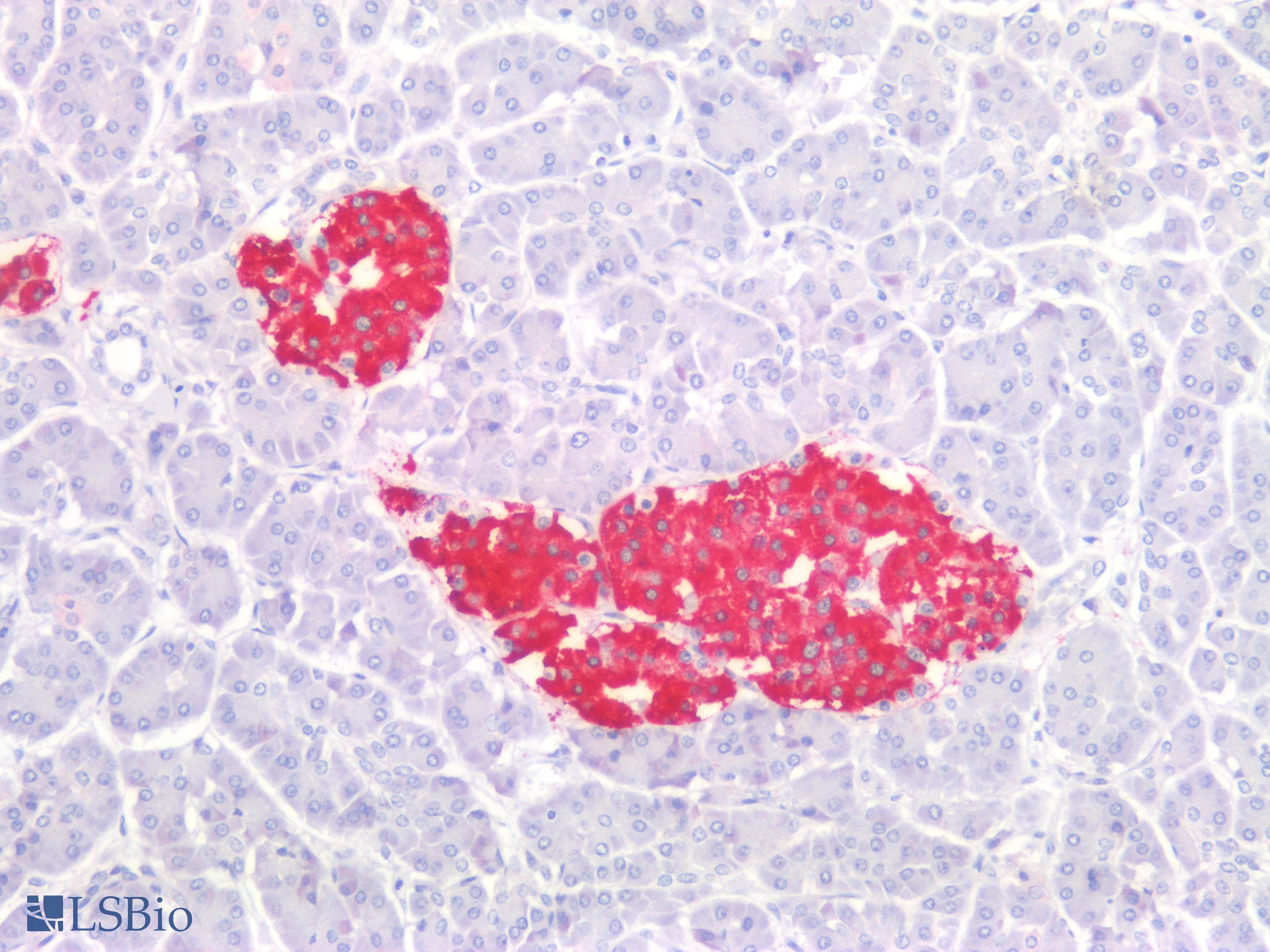 PathPlus™ Insulin Antibody
