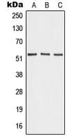 Polyclonal Rabbit anti-Human ANGPT4 / Angiopoietin-4 Antibody (Internal, WB)