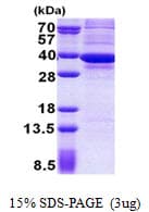 Human ATP5C1 Protein (Recombinant His)
