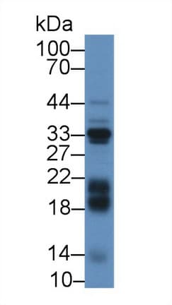 IGFBP3 Antibody (aa106-241)