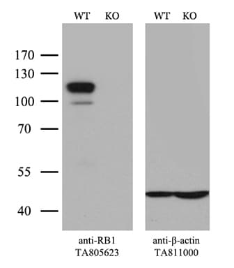 Monoclonal Mouse anti-Human RB1 / Retinoblastoma / RB Antibody (clone OTI11C10, aa309-590, IHC, WB)