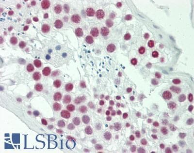 SAFB1 / SAFB Antibody (aa875-C-term)