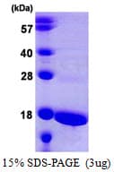Human ATP5D Protein (Recombinant His)