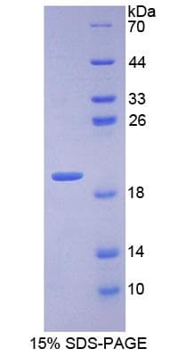 Mouse INPP4A Protein (Recombinant His-S)
