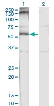 Monoclonal Mouse anti-Human CHRND Antibody (clone 2B2, WB)