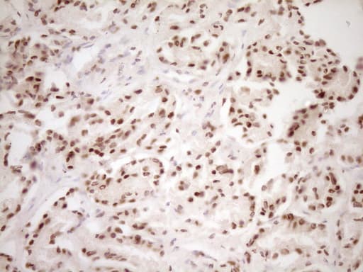LPIN1 / Lipin 1 Antibody (clone OTI8F10)
