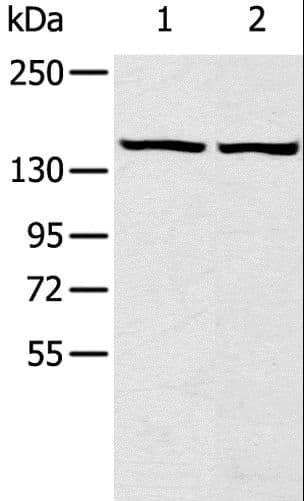 TBC1D4 / AS160 Antibody