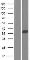 CCDC137 Protein (Over-Expression Lysate Myc-DDK (Flag))