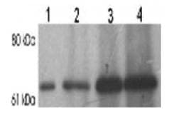 IHC-plus™ Polyclonal Rabbit anti-Human STXBP2 Antibody (aa58-70, IHC, WB)
