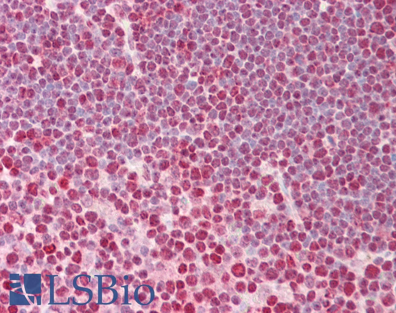 IHC-plus™ HNRNPC / HNRNP C Antibody (aa241-290)