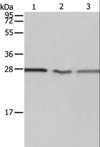 PSMD9 / 26S Proteasome Antibody