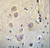 Polyclonal Rabbit anti-Human RHOB Antibody (aa104-137, IHC, WB)