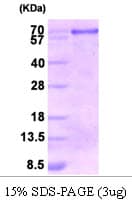 Human CANX / Calnexin Protein (Recombinant)