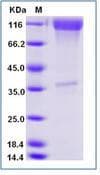 Mouse CSF1R / CD115 / FMS Protein (Recombinant Human IgG Fc, C-terminus)