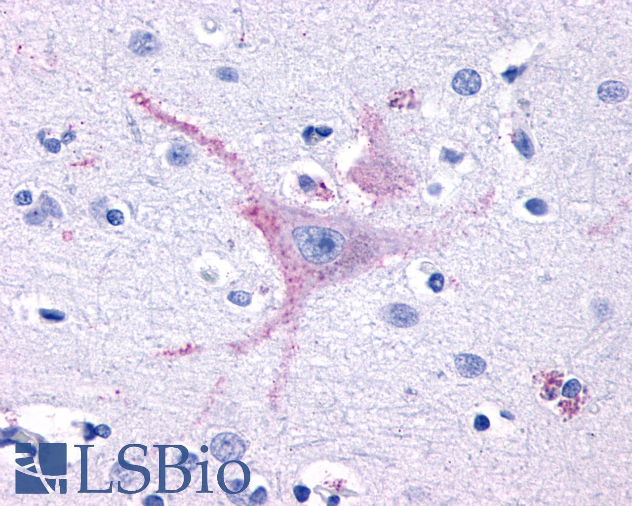 IHC-plus™ Polyclonal Rabbit anti-Human GPR32 Antibody (Extracellular Domain, IHC)