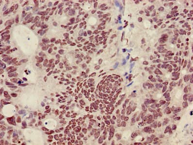 Polyclonal Rabbit anti-Human HIST1H3A Antibody (IHC, IF)