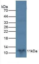 S100B / S100 Beta Antibody (aa1-92)