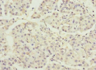 DNAJB2 Antibody