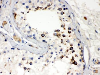 DIABLO / SMAC Antibody