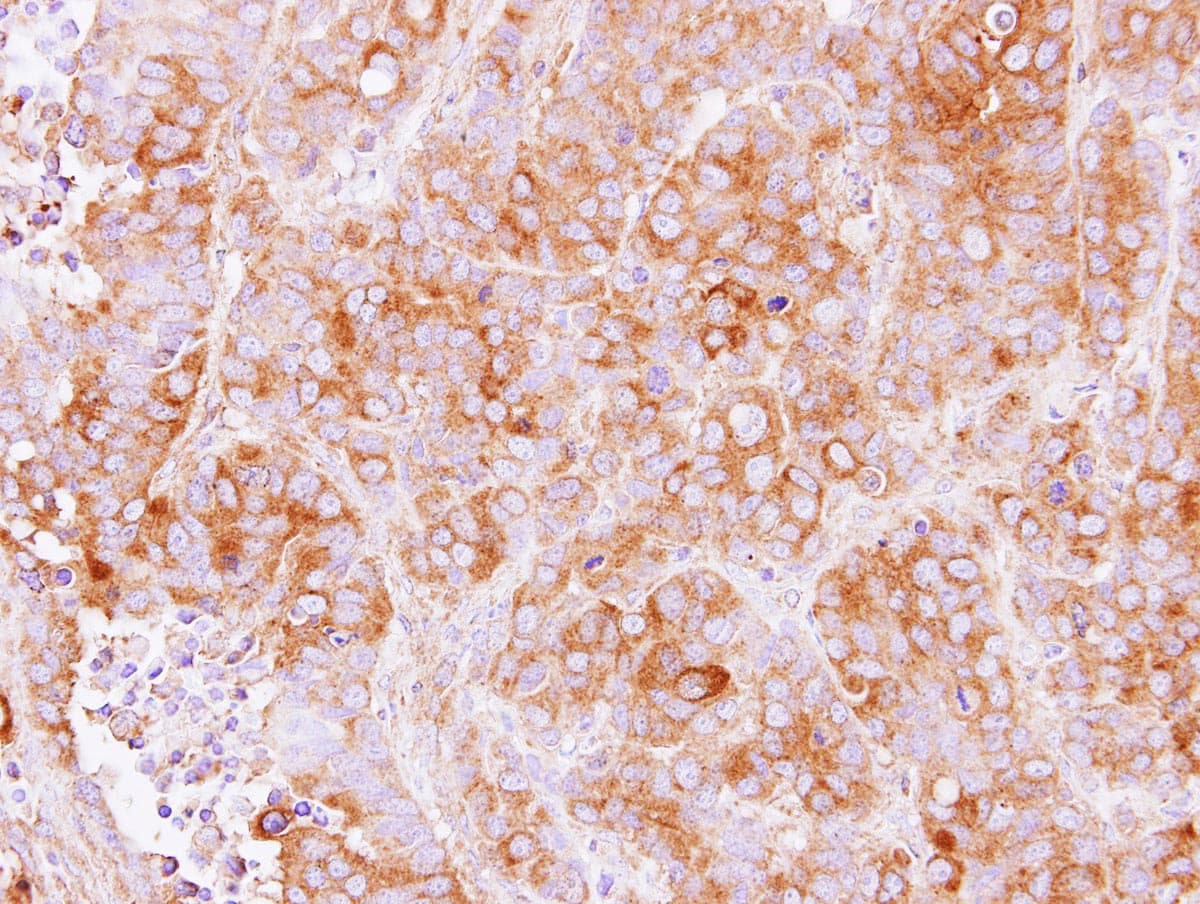 TMED2 Antibody (aa9-201)
