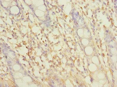 Polyclonal Rabbit anti-Human SLC6A16 Antibody (IHC)