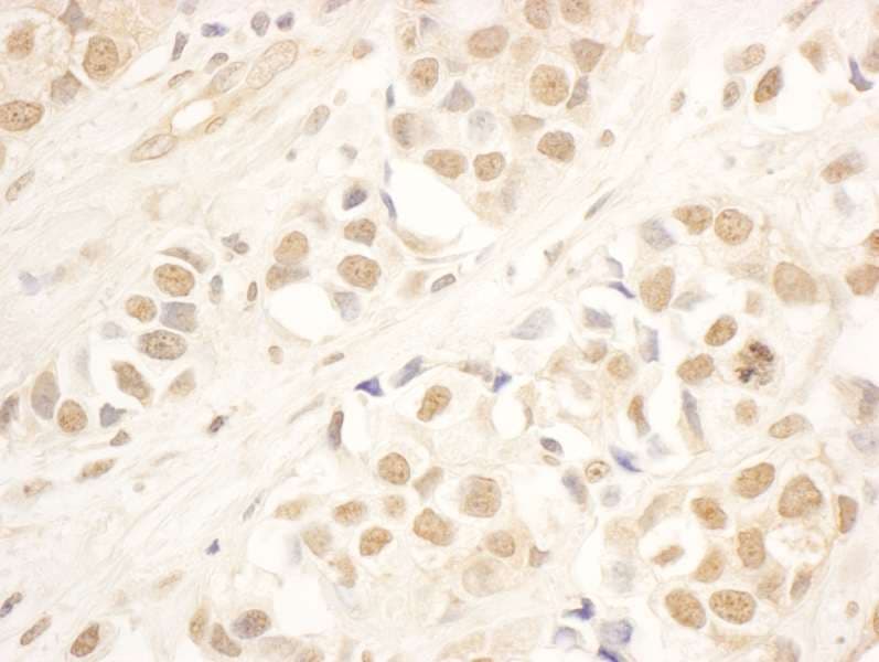 Polyclonal Rabbit anti-Human NOP58 / NOP5 Antibody (aa350-400, IHC)