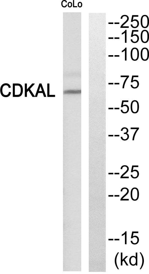 Polyclonal Rabbit anti-Human CDKAL1 Antibody (WB)