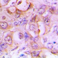 KLRD1 / CD94 Antibody