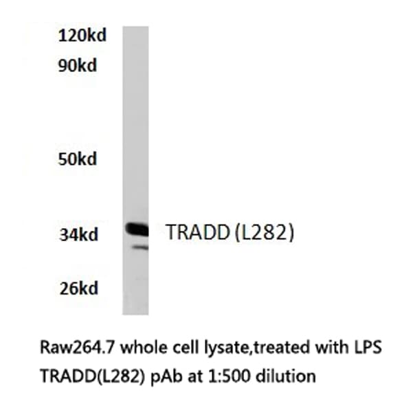 Polyclonal Rabbit anti-Human TRADD Antibody (Leu282, IHC, WB)