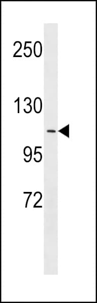 Polyclonal Rabbit anti-Human APOBR / APOB48R Antibody (aa596-622, WB)