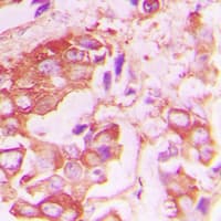 Polyclonal Rabbit anti-Human INSR / Insulin Receptor Antibody (C-Terminus, IHC, WB)