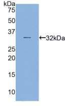 MYH16 Antibody