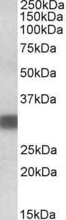 IHC-plus™ PDXP / Pyridoxal Phosphatase Antibody (aa275-286)