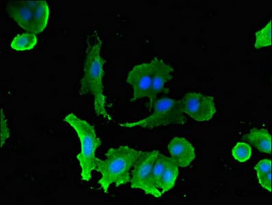 SLC5A1 / SGLT1 Antibody