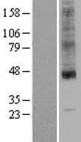Human SLC35A1 Protein (Over-Expression Lysate Myc-DDK (Flag))