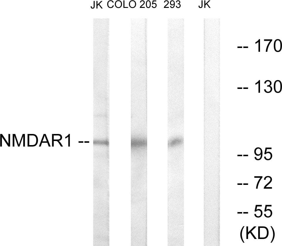 GRIN1 / NMDAR1 Antibody (p896)