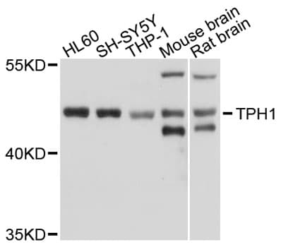 IHC-plus™ TPH1 / Tryptophan Hydroxylase Antibody