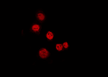 N4BP1 Antibody