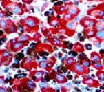 Melanoma Antibody (clone PNL2, Ready-to-Use)