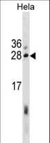 EBAG9 / RCAS1 Antibody (aa88-117)