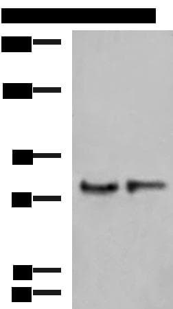 GPSM1 / AGS3 Antibody