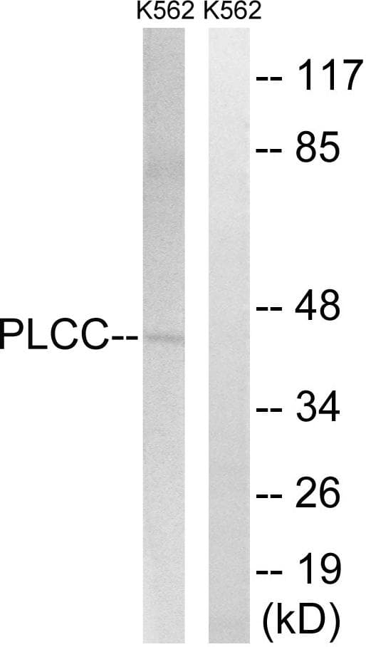 AGPAT3 Antibody