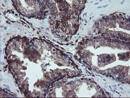 TSC22D1 / TSC22 Antibody (clone OTI1A5)