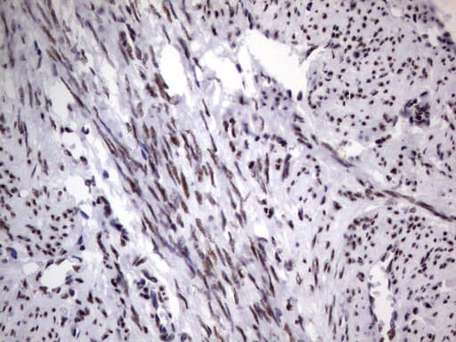 DDX56 Antibody (aa323-547, clone UMAB152)