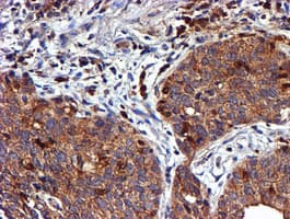 LIMK1 / LIMK Antibody (clone OTI6B4)