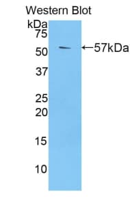 PZP Antibody (aa1224-1495, Biotin)